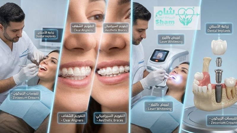 مجموعة صور توضح أنواع تجميل الأسنان في سوريا: زراعة الأسنان، تلبيسات الزيركون، التقويم الشفاف، وتبييض الأسنان بالليزر بأحدث الأجهزة.