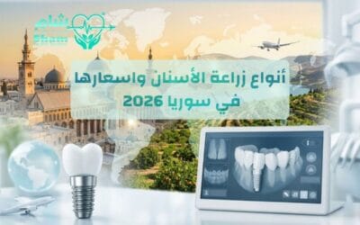 أنواع زراعة الأسنان واسعارها في سوريا 2026 | وفر 60% من التكاليف