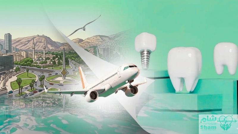علاج الأسنان في سوريا وتركيب الفينير