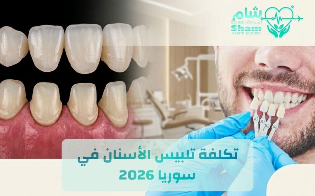 تكلفة تلبيس الأسنان في سوريا 2026: دليل الأنواع والأسعار مع شام للسياحة العلاجية