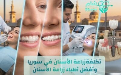 تكلفة زراعة الأسنان في سوريا 2026 | الأنواع والأسعار وأفضل الأطباء