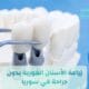 زراعة الأسنان الفورية بدون جراحة في سوريا