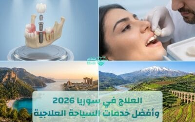 العلاج في سوريا 2026 وأفضل خدمات السياحة العلاجية مع شام (وفر 60%)