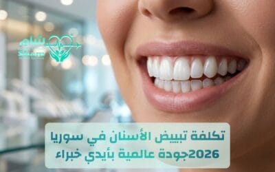تكلفة تبييض الأسنان في سوريا 2026 | مراكز تجميل الأسنان في سوريا