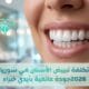 تكلفة تبييض الأسنان في سوريا 2026 - ابتسامة هوليود