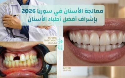 معالجة الأسنان في سوريا 2026 | لماذا يختار المغترب دمشق للسياحة العلاجية ؟
