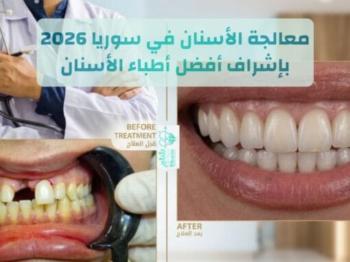 معالجة الأسنان في سوريا 2026 | لماذا يختار المغترب دمشق للسياحة العلاجية ؟